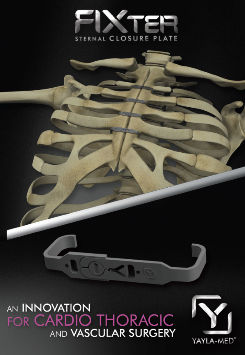 STERNUM KAPATMA PLAĞI