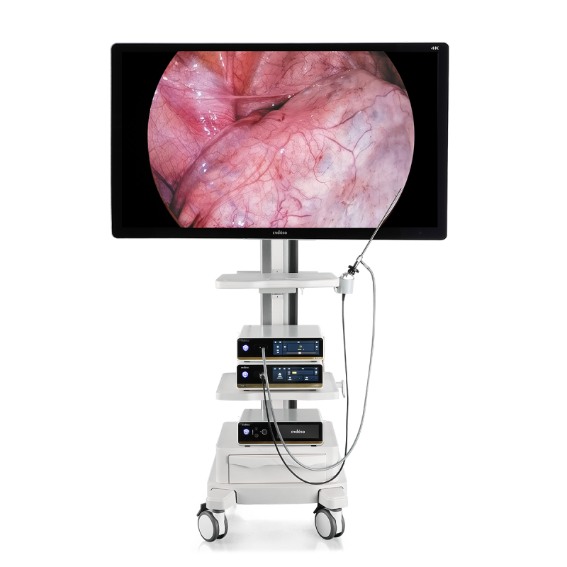 Endoscope Camera System