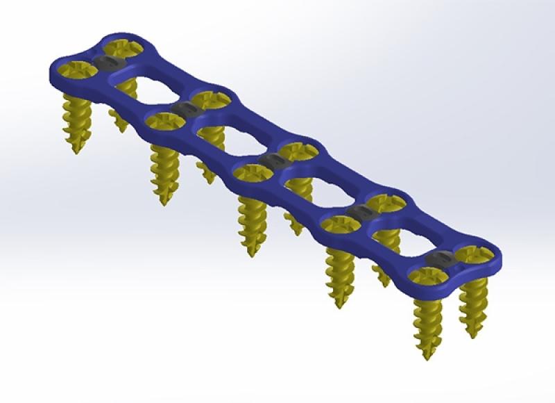 ANTERİOR SERVİKAL PLAK