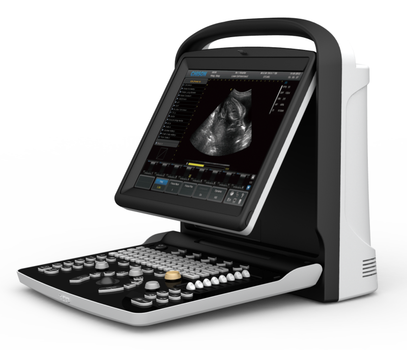 Chison ECO3 Expert Portable Ultrasound System