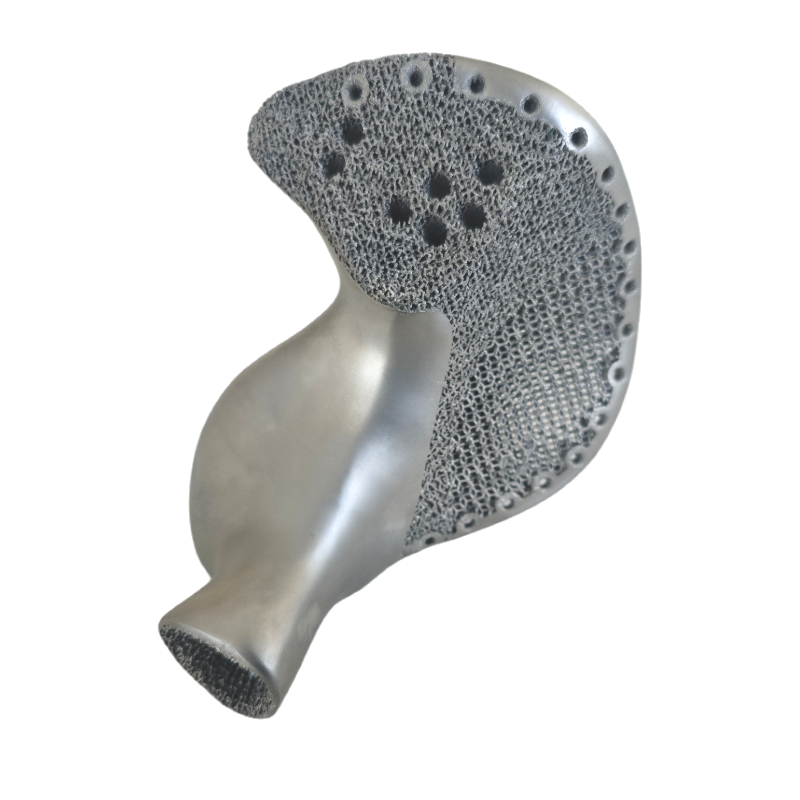 3D printed titanium alloy personalized implants
