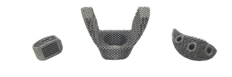 3D printed tantalum personalized implants