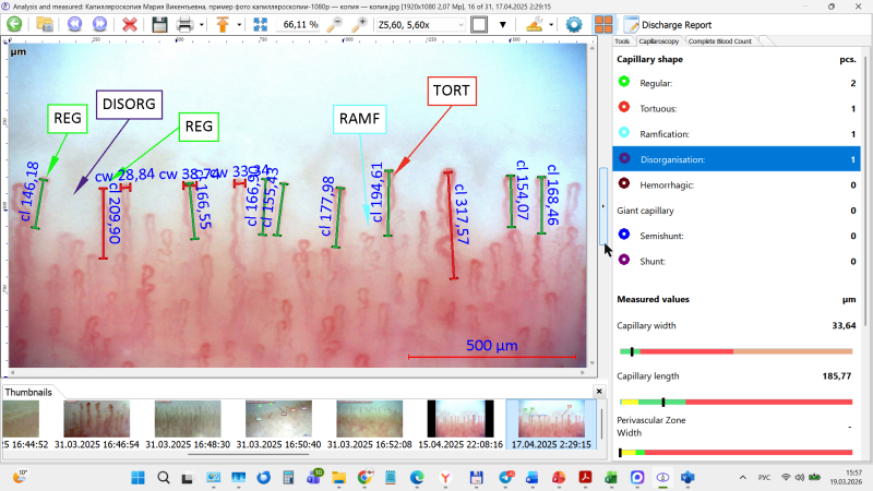 Dianel®-Micro Kapillaroskopi Yazılımı