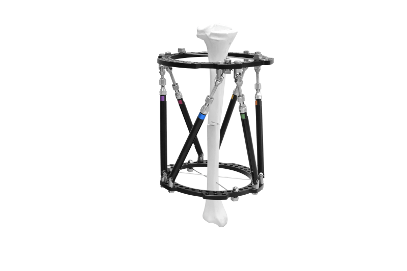 Ortopedik dış fiksasyon